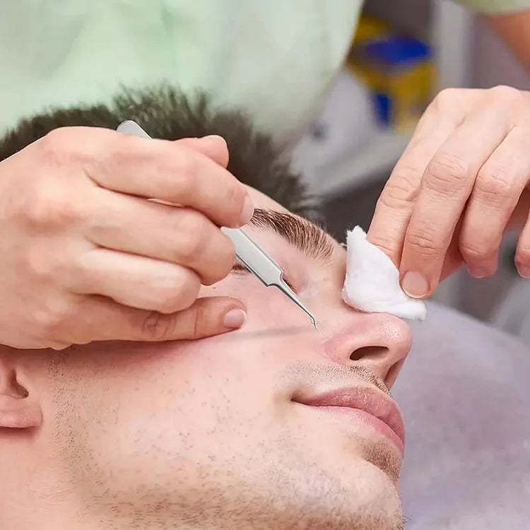 طقم احترافي لإزالة الرؤوس السوداء والشعر من الوجه، 3 قطع + علبة