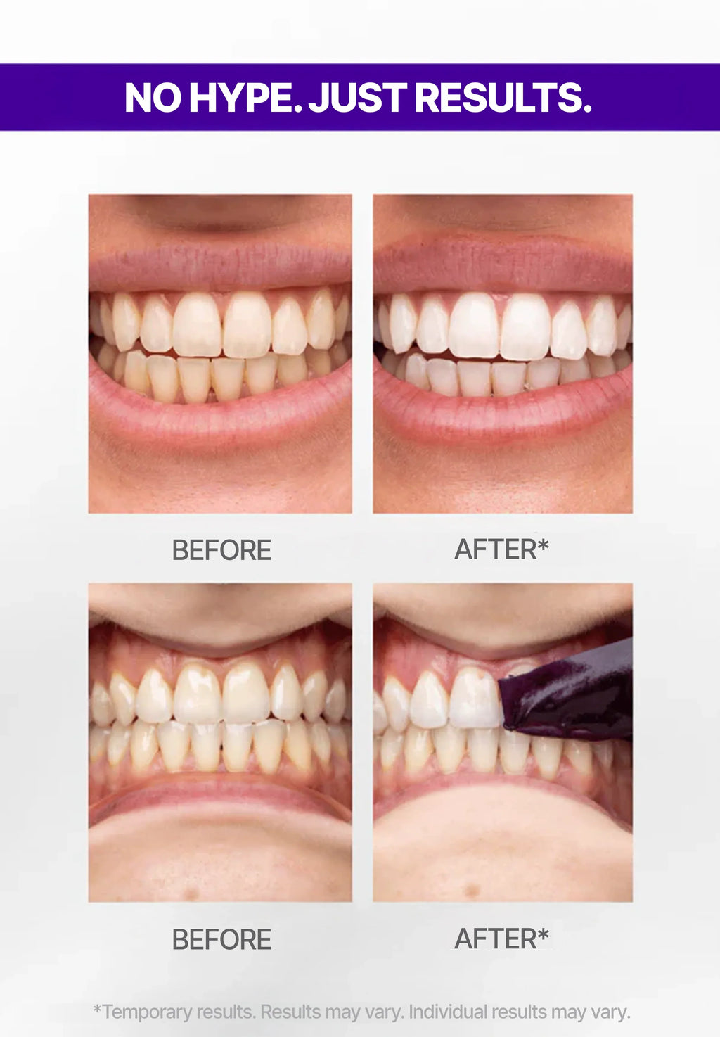 LumiSmile V34 Purple Teeth Whitening Strips — PAP+ Color Correction