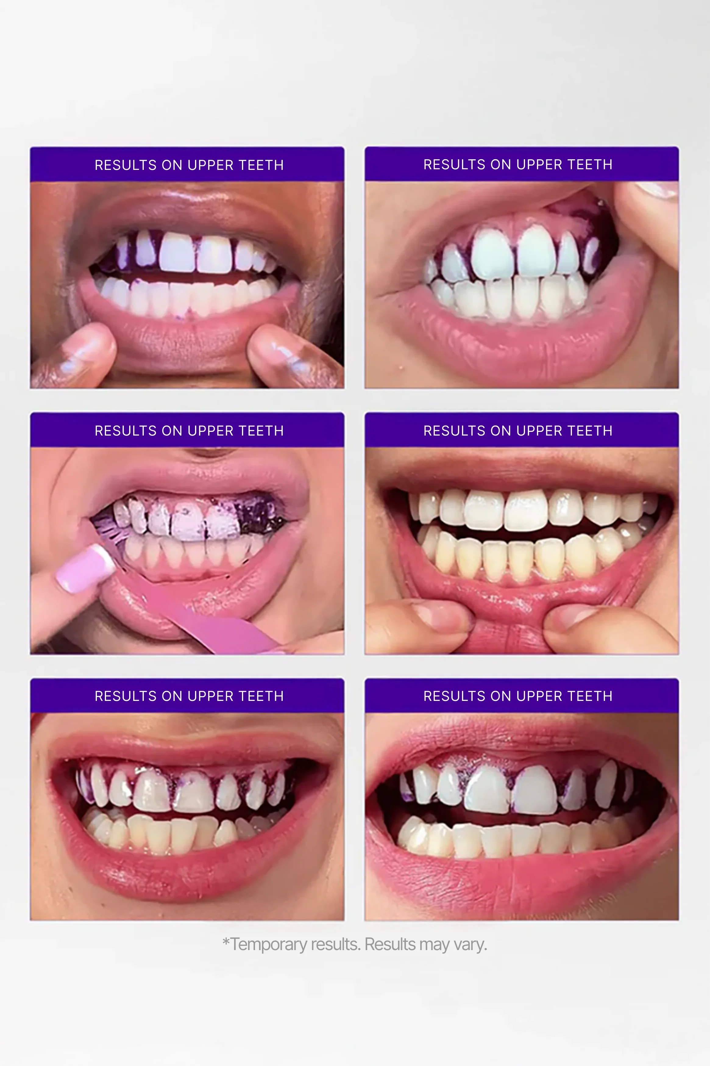 LumiSmile V34 Purple Teeth Whitening Strips — PAP+ Color Correction