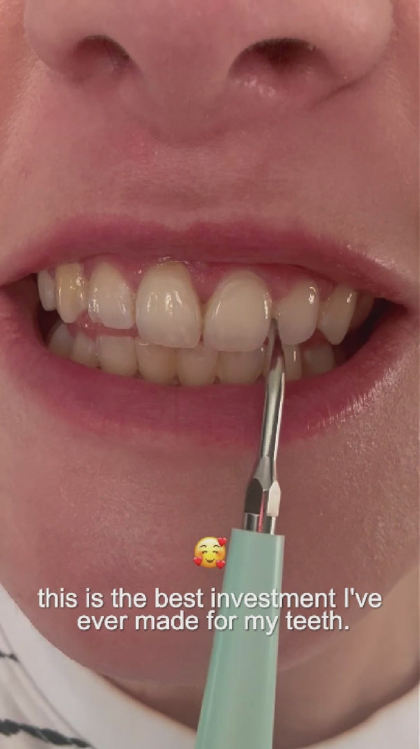 Elite Smile Technology prémium szónikus fogtisztító — professzionális szájápolási eszköz