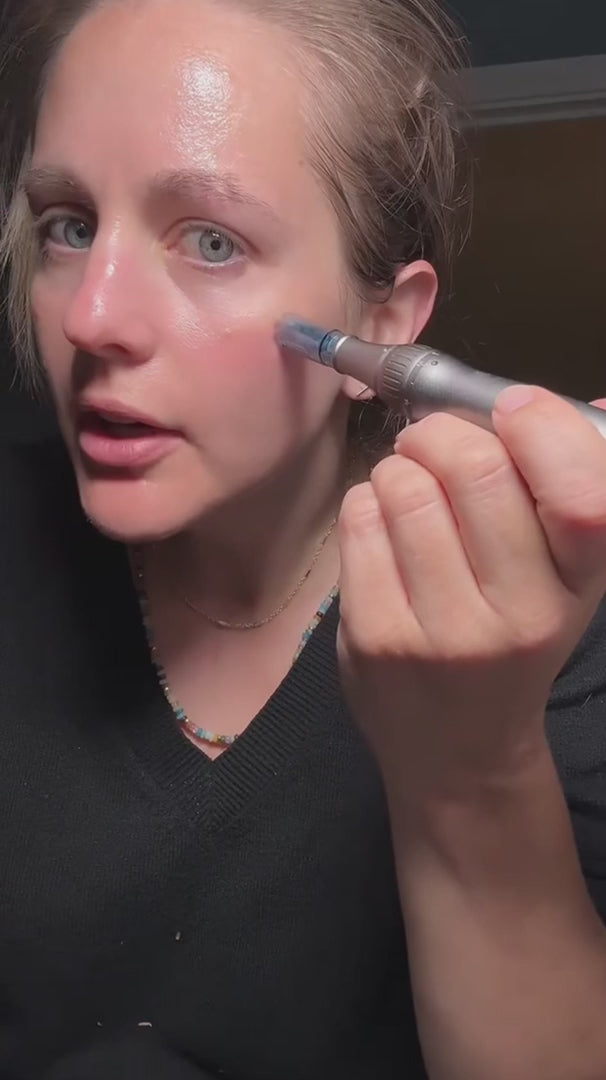 Bolígrafo de cartucho de espiral nano — dispositivo de microneedling con microcanales